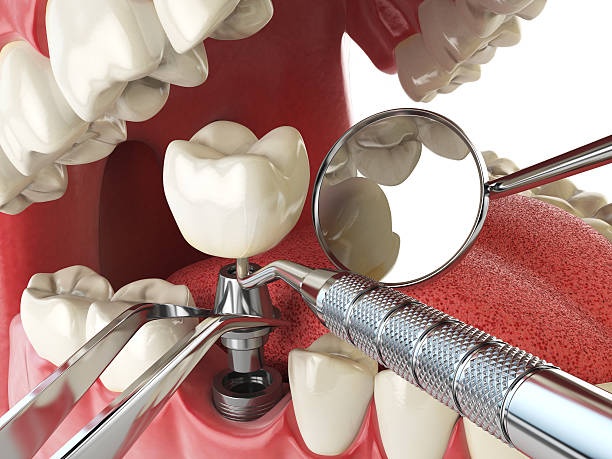 Best Emergency Treatment for Jaw Pain or Injury in Oxoboxo River, CT